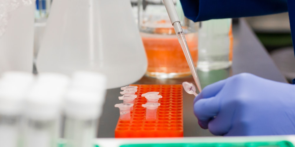 Yurtdışına Çıkarken PCR Testi Yapılabilecek Yerler ve Laboratuvarlar